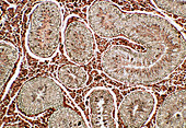 Light micrograph of a normal human testis