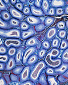 Light micrograph of normal human epididymis