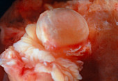 A mature ovarian follicle containing a ripe egg