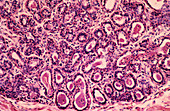 Light micrograph of human mammary gland