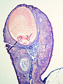 LM of human ovary showing a graafian follicle