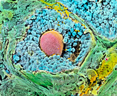 SEM of secondary follicles in the ovary