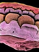 Coloured SEM of the uterus-oviduct junction