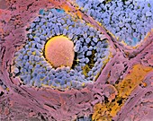 Coloured SEM of secondary follicles in the ovary