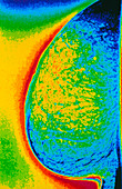 Coloured mammogram X-ray of healthy breast