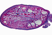 Light micrograph of a section through an ovary