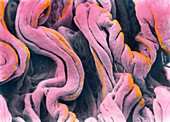 Coloured SEM of surface of vaginal epithelium