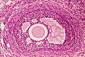 LM of section through a Graafian follicle in ovary