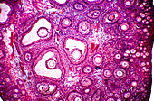 Follicles in a human ovary,micrograph