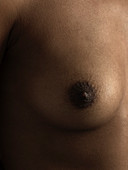 Woman's breast