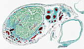 Fallopian tube section,light micrograph