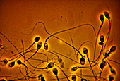 LM of normal human sperm
