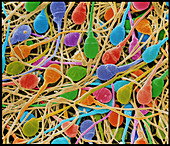 Coloured SEM of human sperm