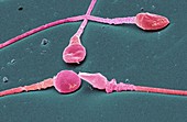 Human sperm cells,SEM