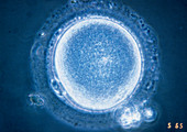 LM of mature human oocyte (metaphase I stage)