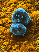 SEM of two primordial egg cells
