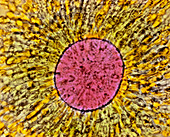Coloured LM of mature human oocyte