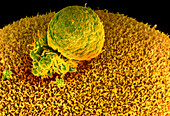 Coloured SEM of human egg surface with polar body