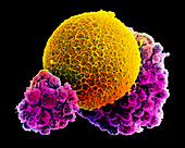 Colour SEM of human egg with corona radiata cells