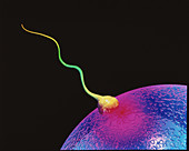 Computer art of sperm and egg during fertilisation