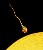 Computer art of sperm and egg during fertilisation