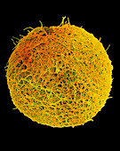 Coloured SEM of sperm on egg during fertilisation