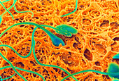Coloured SEM of sperm on egg during fertilisation