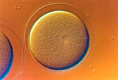 LM showing fertilization of sea urchin's egg
