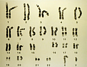 LM of a set of normal male chromosomes