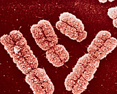 False-colour SEM of a group of human chromosomes