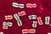 Coloured SEM of a group of human chromosomes