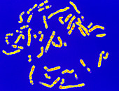 Coloured LM of a normal male karyotype