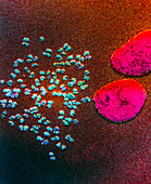 Coloured SEM of human chromosomes and two nuclei