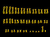 Computer artwork of a human male karyotype