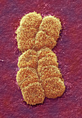 Human chromosome