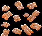 Human chromosomes,SEM