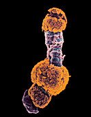 Col SEM of giant chromosome from salivary gland