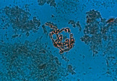 LM of giant chromosomes of a fruit fly