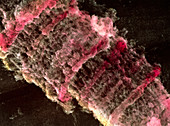 SEM of Drosophila giant (polytene) chromosome