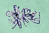 Lampbrush chromosomes,TEM