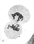 TEM of mitosis (telophase) of human kidney cell