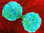Coloured SEM of hepatocyte undergoing cytokinesis