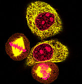 Mitosis,light micrograph