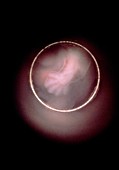 Human embryo: hand