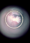 Human embryo: hand