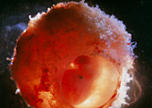 The human embryo after 5-6 weeks