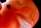 Head of the human embryo at around 7 weeks