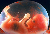 Foetus aged 14 weeks