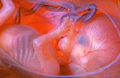 Foetus aged 13 weeks