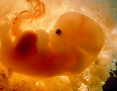 Human embryo after 7 weeks